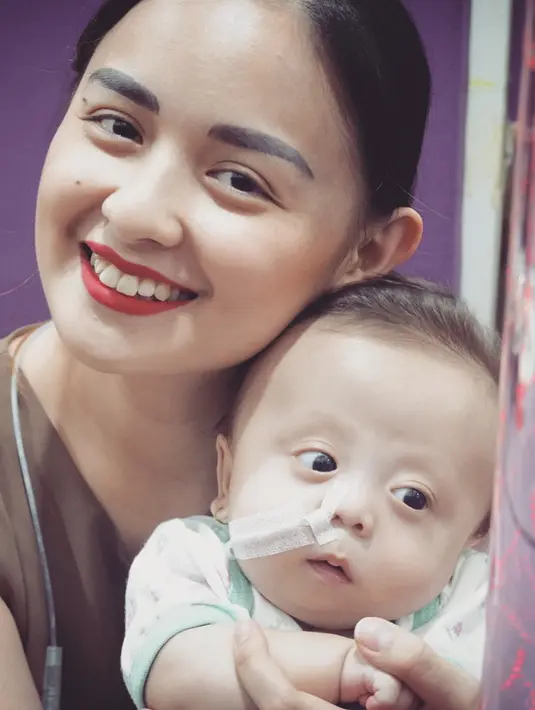 Perlahan selang yang membantu pernapasan pun mulai dibuka dan ia mulai dilatih untuk makan dan minum. (Foto: instagram.com/joannaalexandra)