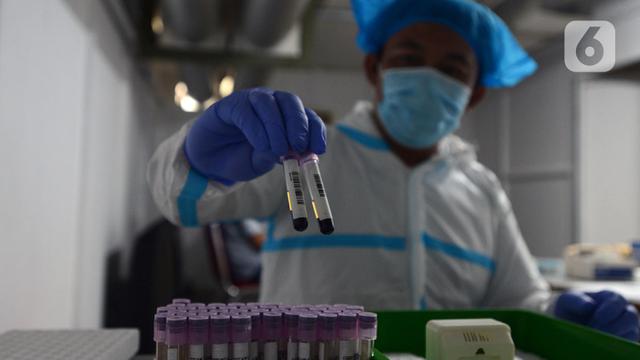 FOTO: Jelang New Normal, Pegawai KLY Jalani Rapid Test