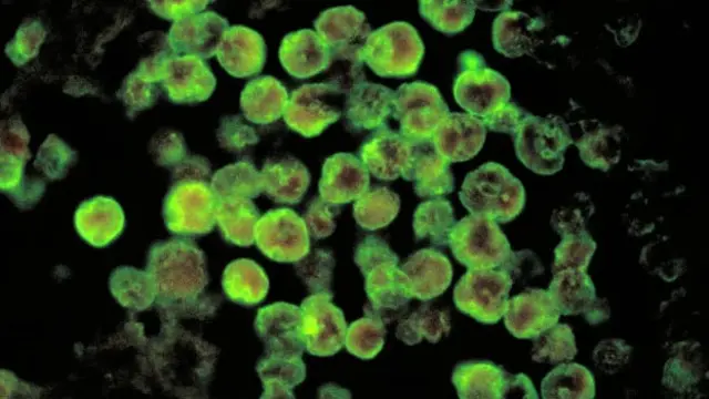 Naegleria fowleri (CDC)
