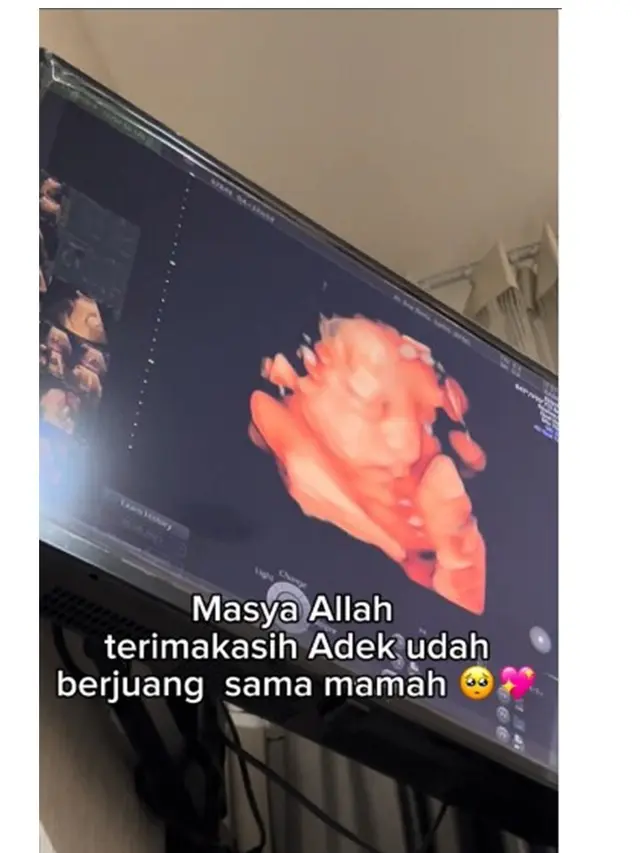 Dirahasiakan 8 Bulan, Ini 8 Potret Tasyi Athasyia Umumkan Hamil Anak Ke-4