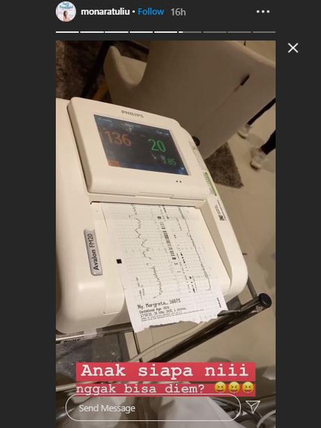 6 Momen Lahiran Anak Keempat Mona Ratuliu, Penuh Haru Bareng Suami