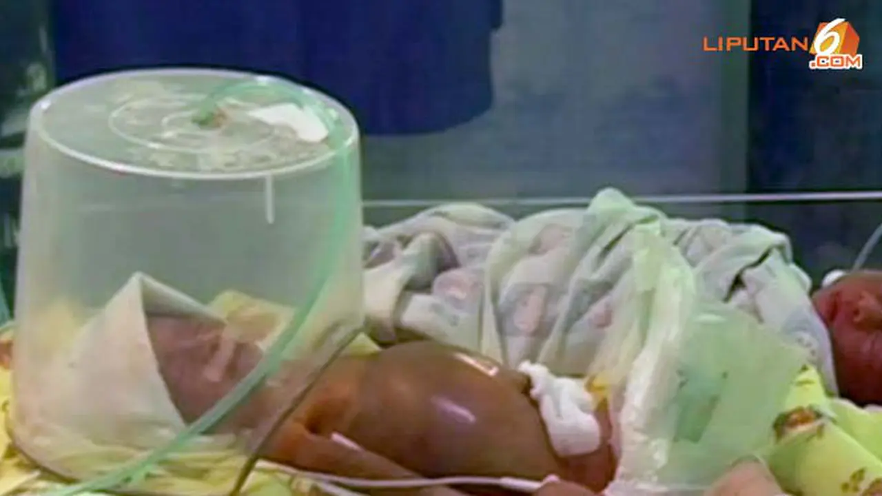 bayi-tanpa-anus130531a.jpg