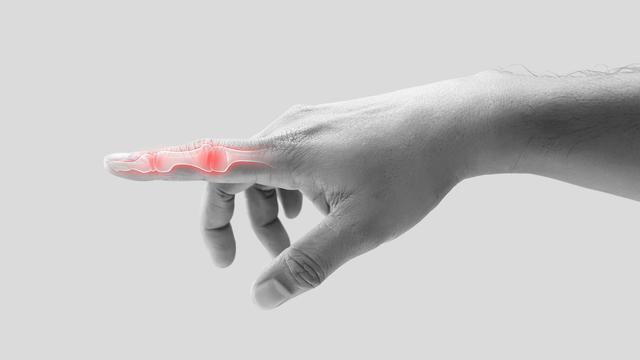 Ilustrasi inflamasi pada jari