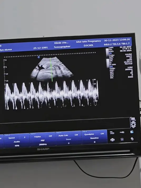 Dalam video singkatnya Icha juga menunjukan suara detak calon bayi dalam kandungannya. [Foto: Instagram/ichasoebandono]