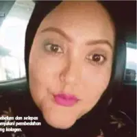 Girls, kamu berniat untuk suntik kolagen? Coba pikir-pikir lagi dan baca kisah menyedihkan wanita yang ketagihan suntik kolagen ini. (Foto: MyNewsHub)