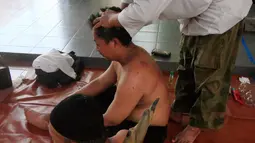Dua lelaki sedang melakukan terapi bekam tanduk di Masjid Malioboro, Yogyakarta, Minggu (17/4). Di Tiongkok, bekam tanduk telah dilakukan sejak abad ke 18. (Liputan6.com/Boy Harjanto)