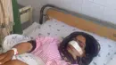 Reza Gul (20) saat tergolek lemah di sebuah rumah sakit di Provinsi Faryab, Afghanistan, 19 Januari 2016. Wanita yang telah enam tahun menikah itu mengalami cacat fisik setelah sang suami memotong hidungnya dengan pisau. (AFP PHOTO/Hasan Sirdash)