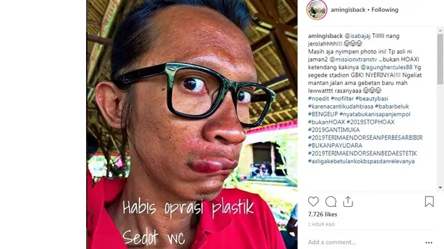 Aming (Foto: Instagram)