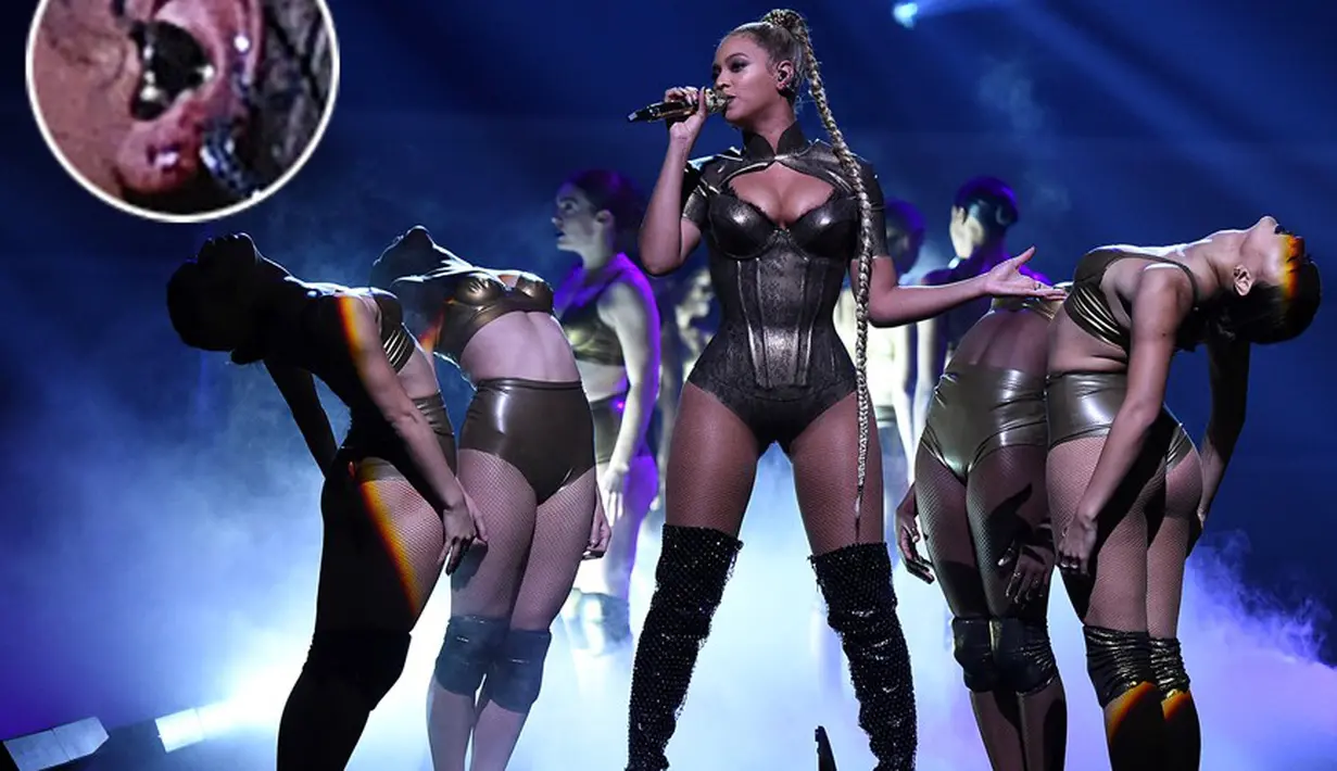 Seorang public figure terkadang harus terlihat baik-baik saja di depan umum meski sebenarnya menyakitkan. Seperti halnya Beyonce di atas panggung, meski darah sudah bercucuran ia tetap melanjutkan penampilannya. (doc.People.com)