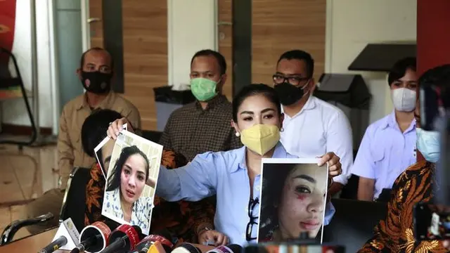 Nindy Ayunda tunjukkan bukti KDRT