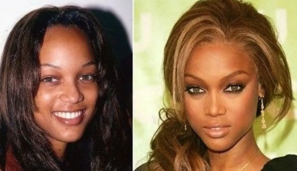Model kelas dunia, Tyra Banks pun mengaku dirinya melakukan operasi hidung sebelum memulai kariernya. (Celebrity plastic surgery online)