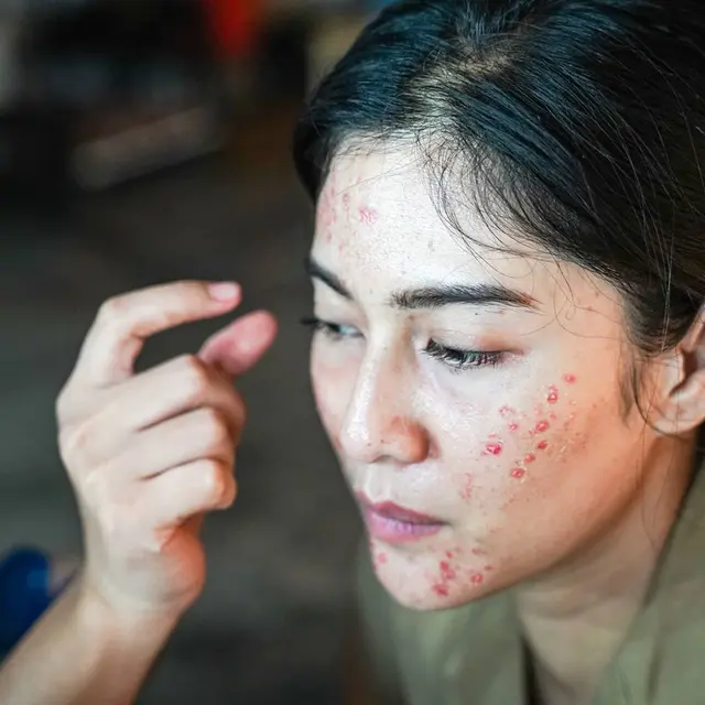 Demi Film Ini 7 Potret Dian Sastro Tampil Jerawatan yang Curi Perhatian