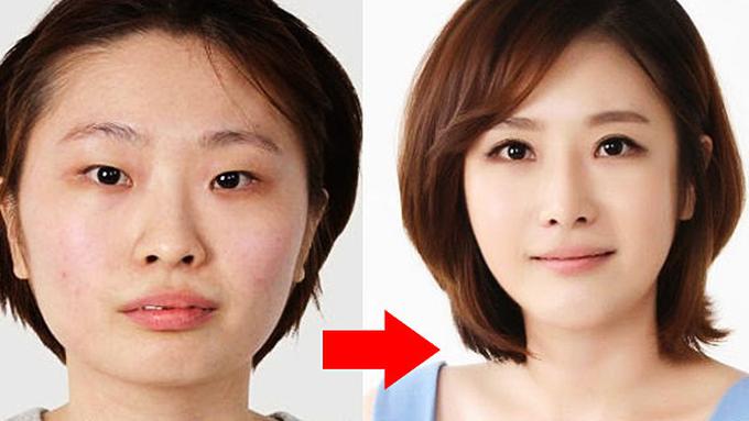 Tempat Operasi Plastik Terbaik Di Korea - Sederet Tempat
