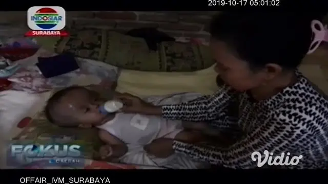 Seorang bayi sepuluh bulan di Nganjuk, Jawa Timur, menderita hidrosefalus. Kepala sang bayi terus membesar meski sudah berulang kali berobat ke rumah sakit.