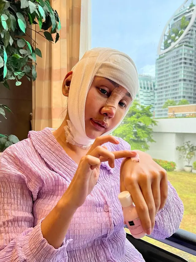 7 Potret Lucinta Luna Kembali Jalani Operasi Plastik, Bikin Geleng Kepala