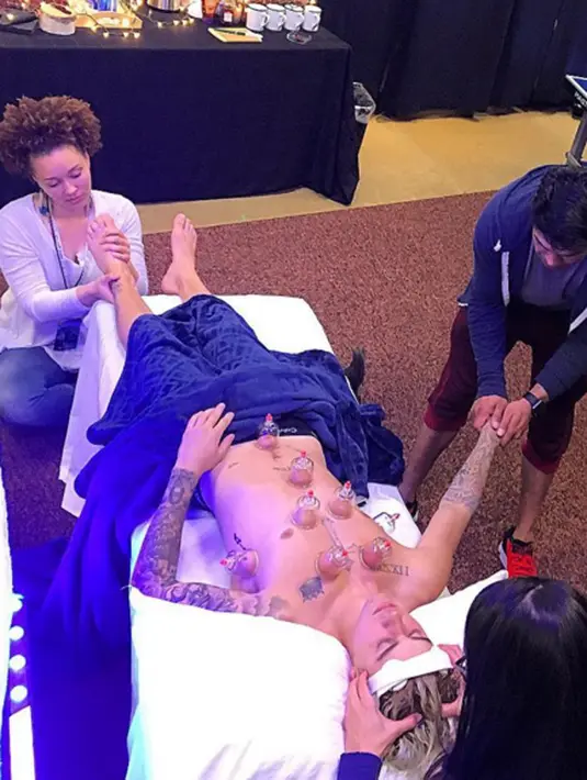 Dalam foto yang diunggah oleh kawan Justin Bieber yakni Johnny Shahidi, ia mengunggah foto Justin Bieber sedang terbaring dan tubuhnya dipenuhi 7 alat bekam. (viainstagram@johnshahidi/Bintang.com)