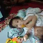 Dua bayi kembar siam asal Kendari, Aqila Dewi Sabila dan Azila Dewi Sabrina.(Liputan6.com/Ahmad Akbar Fua)