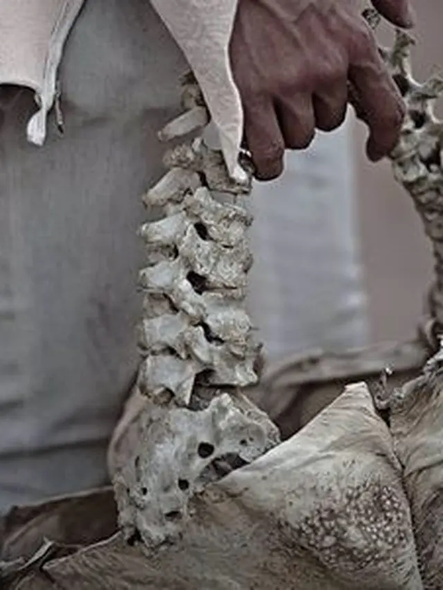 Tas dari tulang belakang manusia