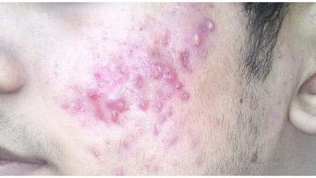 Foto : copyright listverse.com