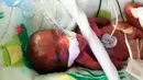 Foto pada Desember 2018 memperlihatkan seorang bayi yang dipanggil dengan nama Saybie. Bayi perempuan itu lahir dengan berat 245 gram di Rumah Sakit Ibu dan Anak Sharp Mary Birch, kata rumah sakit itu saat mengumumkan kelahiran dan kepulangan Saybie pada Rabu (29/5). (Sharp HealthCare via AP)