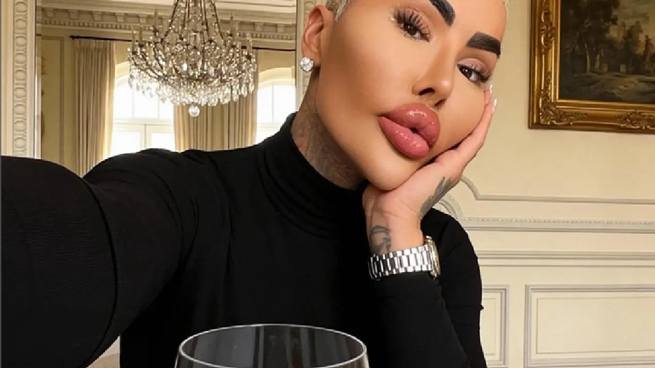 Akhir Tragis Pria yang Terobsesi Menjadi Kim Kardashian, Meninggal Diduga karena Operasi Plastik