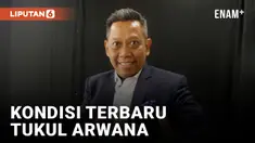 Kondisi Terbaru Tukul Arwana