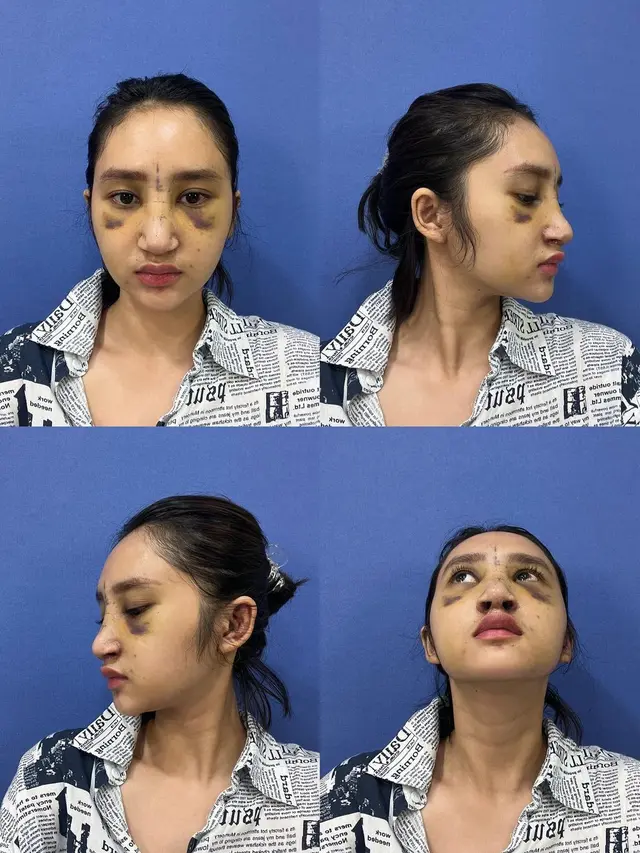Didukung Lakukan Operasi Plastik, Ini 7 Potret Transformasi Putri Farida Nurhan