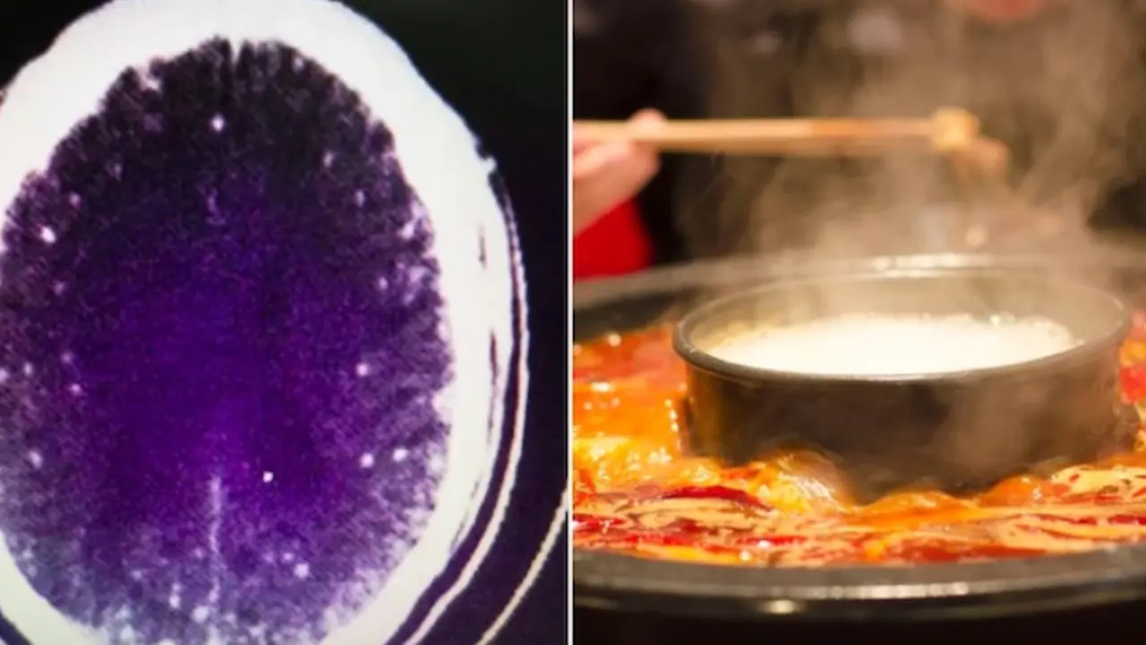Makan Daging Kurang Masak, Pria Ini Alami Kejang-Kejang
