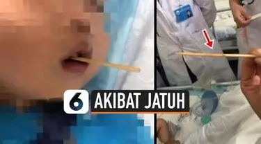 Bocah asal China usia 2 tahun harus dilakukan operasi besar, akibat tusukan sate menembus sampai ke otaknya. Ini disebabkan saat ia makan sate sosis dan terjatuh.