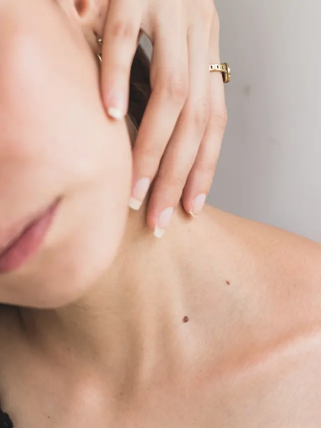 Penyebab dan Gejala Psoriasis Vulgaris