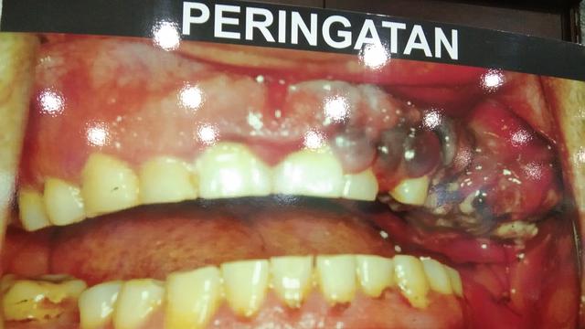 Kementerian Kesehatan Republik Indonesia rilis gambar baru kemasan rokok di Jakarta, Kamis (31/5/2018) (Foto: Liputan6.com/Giovani Dio Prasasti)