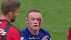 Pelipis Wayne Rooney pecah usai terkena hantaman bek Bournemouth, Simon Francis. This video is presented by Ballball