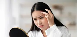 Ilustrasi perempuan cantik dengan kondisi wajah yang sedang breakout. (depositphotos.com/Milkos)
