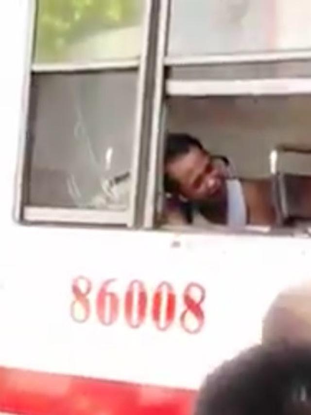 pria kehilangan tangan saat tidur di bus (foto: Facebook The Philippines News)