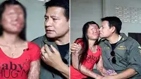 Meski Wajah Isterinya Hancur, Pria Ini Tetap Setia