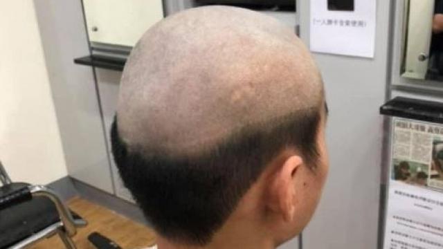 6 Gaya Rambut Bagian Belakang Ini Absurd, Bikin Tepuk Jidat