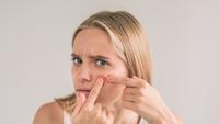 Manfaat Kunyit, Pegagan, dan Lidah Buaya untuk Enyahkan Jerawat Membandel, Bye-Bye Obat Keras!