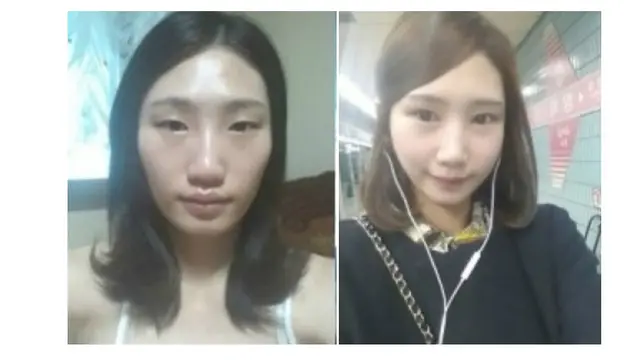 (c) kpsurgery tumblr.com