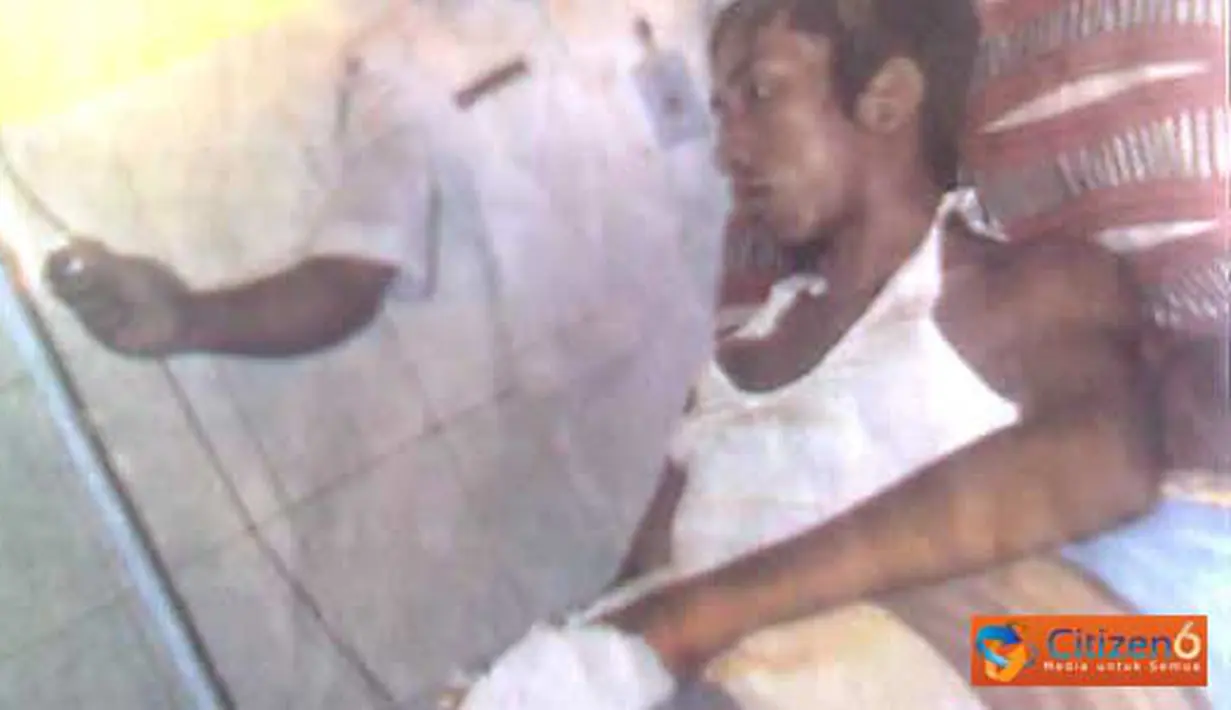 Diduga karena salah paham, Ahmad Jailani (Mamad), warga Sumberwaru, Kecamatan Banyu Putih, menjadi korban pembacokan orang tak dikenal, Kamis (24/3). (Pengirim: Mamad)