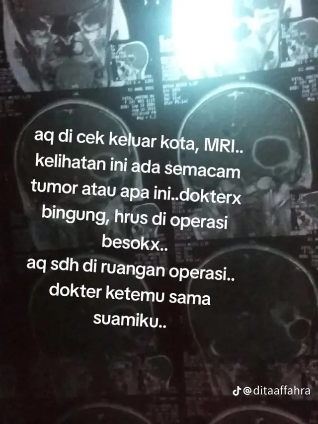 Viral Kisah Pengguna TikTok Ungkap Perjuangannya Hadapi Tumor Otak dan Hilang Ingatan, Mirip yang Dialami Hong Hae In di Queen of Tears (TikTok.com/ditaaffarah)