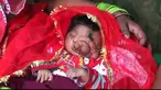 Seorang bayi asal India terlahir dengan hidung yang tampak seperti belalai gajah.Bayi ini dipercayai oleh masyarakat India sebagai reinkarnasi dari dewa Ganesha