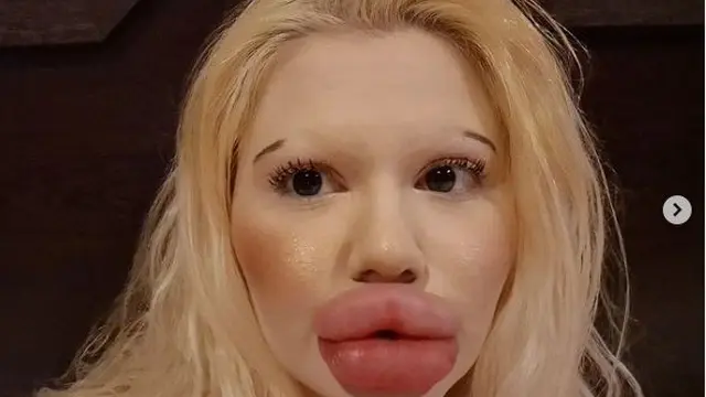 6 Foto Terkini Andrea Ivanova Wanita Viral Bibir Terbesar, Kini Rambutnya Pirang