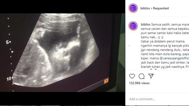 Vanessa Angel (Foto: Instagram/@bibliss)