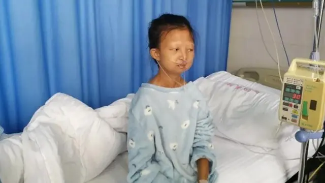 Punya Berat Badan 21 Kilogram di Usia 24 Tahun, Kisah Remaja Ini Bikin Haru