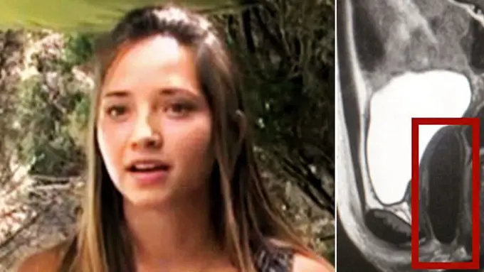 Foto: copyright dailymail.co.uk