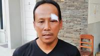 Asisten pelatih Persis Solo, Choirul Huda dengan luka jaihtan di pelipis kirinya. (Bola.com/Vincentius Atmaja)