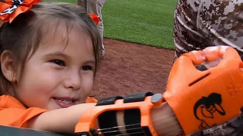 Gadis Kecil Berlengan Robot Jadi Idola di Lomba Baseball Dunia