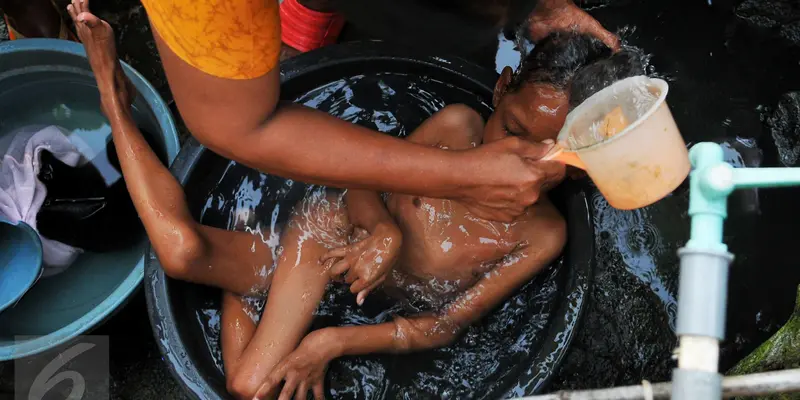 20160711-Perjuangan Nenek Rawat Cucu Kesayangannya yang Berkelainan Tulang Belakang