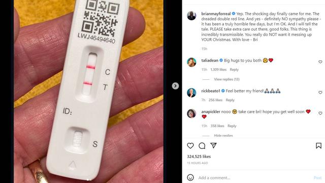 Brian May Gitaris Queen Positif Covid19, Kirim Pesan