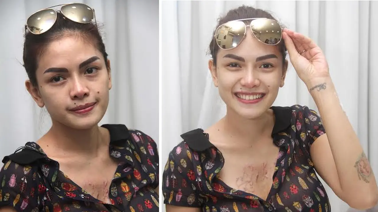 Usai Melahirkan, Nikita Mirzani Jalani Treatment Kecantikan